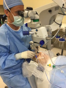retina specialist orange county repairing a macular hole